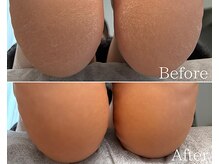 カシェット 広島店(Cachette)/40代女性☆足裏角質ケア90分