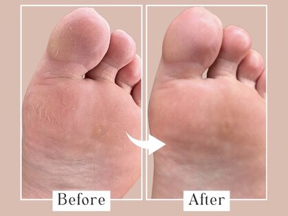 ベベ(Bebe)の写真