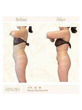 シュプレーム(Supreme)/ヒノキ/自律神経・免疫/首/肩