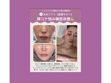 メディカルサロン レムリア/光糸リフト　