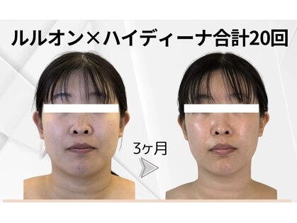 ヨサパーク シピ(YOSAOARK Chipie)の写真