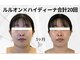 ヨサパーク シピ(YOSAOARK Chipie)の写真