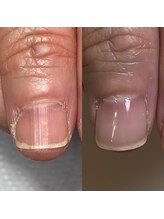 リヒネイル(Rihi.nail)/自爪育成