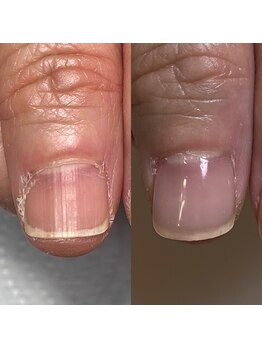 リヒネイル(Rihi.nail)/自爪育成