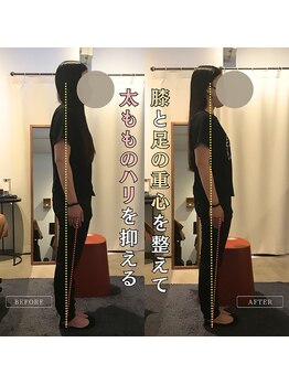 岡山整体 リソル(Resol)/姿勢改善ビフォーアフター