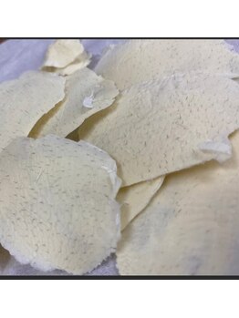 テテアテテ(tete a tete)/【ワックス脱毛】