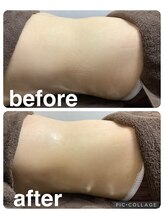 ギンザアール(GINZA R.)/ぽっこりお腹に集中アプローチ！