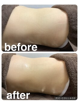 ギンザアール(GINZA R.)/ぽっこりお腹に集中アプローチ！