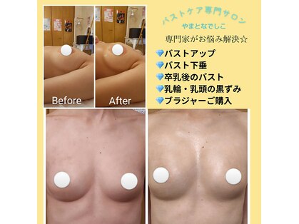 エステティックサロン やまとなでしこの写真
