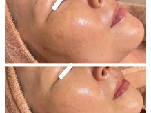 くすみが気になる肌から「肌何してるの？」と憧れられる肌に変化