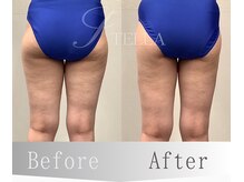 ステラ(STELLA)/下半身プレミアムの効果