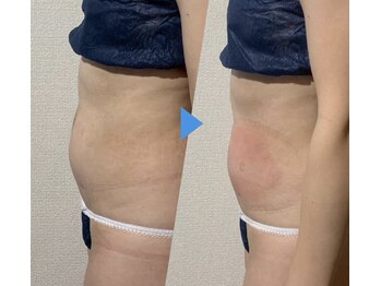 リノリー 古川店(rinory)