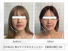 レッド(RED)/もたつきのある輪郭もすっきり