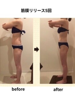 クリア(Clear)/筋膜リリース5回