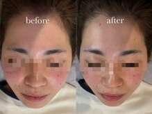 エネ ラッシュアンドブロウ バイ アンドエラ(ENNE Lash&Blow by&ERA)/美脳トレーニングスパ&グロスwax