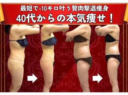 マキシア(MaxiA)の写真