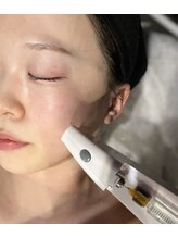 ラリマ グラマラス(Larima Glamorous)