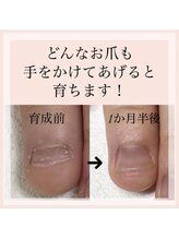 イオネイル(io nail)/自爪育成コース