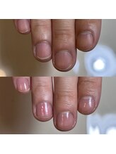 リヒネイル(Rihi.nail)/ネイルケア