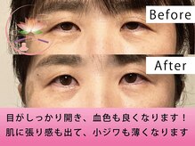 健美庵/本格美容鍼