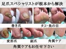 巻き爪補正店 金山店