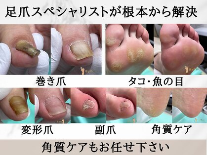 巻き爪補正店 金山店の写真