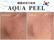 ヘティ バイ ソウル 中目黒(HETIY by Seoul)/アクアピール◇施術1回目