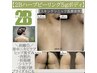 【2Bバイオハーブピーリング5gボディ】肌質改善ニキビケア/肌荒れに剥離◎