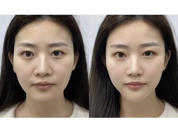 シホン 博多(SHIHON)/