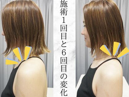 リバティ 世田谷代田整体院(Liberty)の写真
