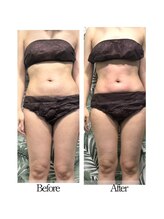 バイブスプラス(Vibes+)/