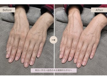 マノ 徳島(mano)の写真/乾燥やくすみ、冷え性...尽きない女性のお悩みに寄り添います。まずは手元のお悩みを聞かせてください。