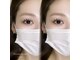 ティセラ(Tissera)の写真