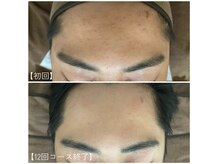 ボヌール 久留米(Bonheur)の雰囲気（効果が分かるサロン/フェイシャルもボディもお任せください◎）