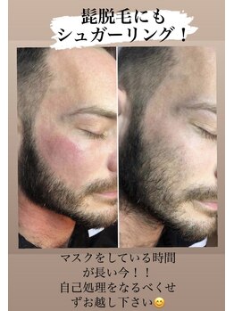 ラミーナ 札幌店(La Mina)/#ブラジリアンワックス
