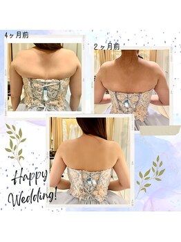 ティアエ(T-ae)/【ブライダルエステ】