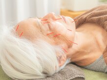 かけこみでらの雰囲気（美容針は約30本を使った贅沢な施術です）