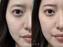 ハリウッドブロウリフト ワクシー 青山店(HOLLYWOOD BROW LIFT WAXYYY.)/『HBLのおかげで毎日快適！』