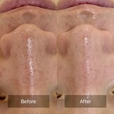 アネラ 南森町(ANERA)