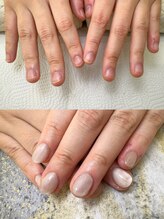 リリ(Rili)/深爪矯正 自爪育成