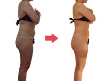 ボディケアルーム リフレキュア 中野(REFLECURE)/フルメソッドだからこそ