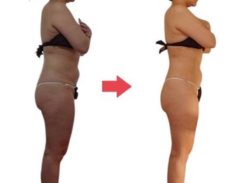 ボディケアルーム リフレキュア 中野(REFLECURE)/フルメソッドだからこそ