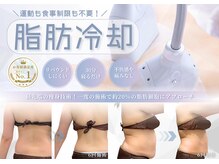 イエス マイサロン(yes My Salon)