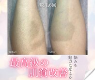 ミーシェ(Meshie)