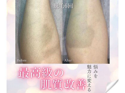 ミーシェ(Meshie)の写真