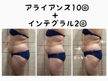 プリマプリート WEST店の写真/くびれが欲しい方必見!インテグラル/アライアンスでスッキリした理想のボディラインを目指そう☆