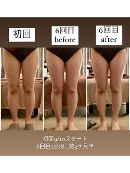 スラン(Slan)/美骨痩身×筋膜リリース60分