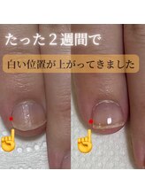 リヒネイル(Rihi.nail)/自爪育成
