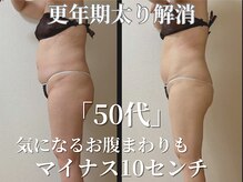 イロイロ(ILO ilo)の雰囲気（短期集中◎年々痩せにくくなってきたお身体もサイズダウン◎）