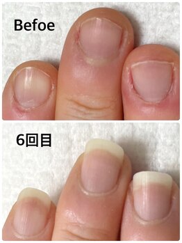 グラティアラ 銀座の写真/噛み爪/深爪/チビ爪さんに[初回肌爪カウンセリング&爪を育てるハンドケア(爪の形整え,甘皮お手入れ)¥12100]